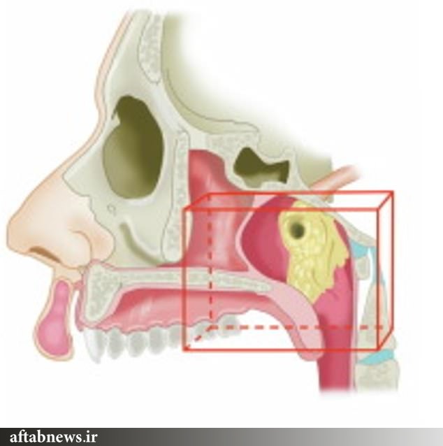 عکس| کشف اندام تازه در گلوی انسان