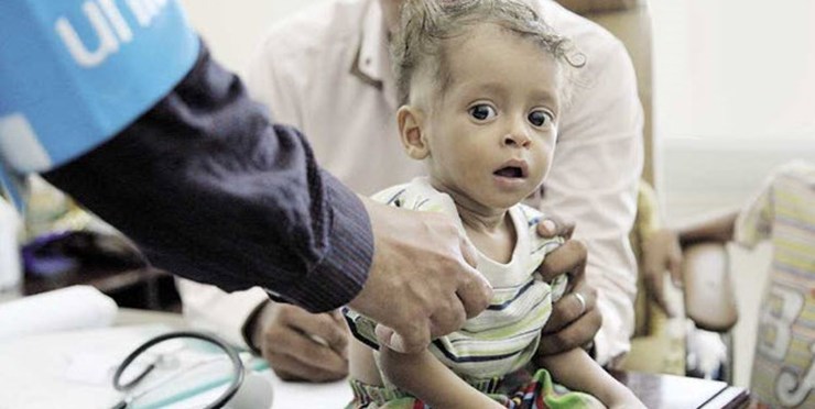 سازمان ملل: میلیون‌ها یمنی در آستانه قحطی جدیدی قرار دارند