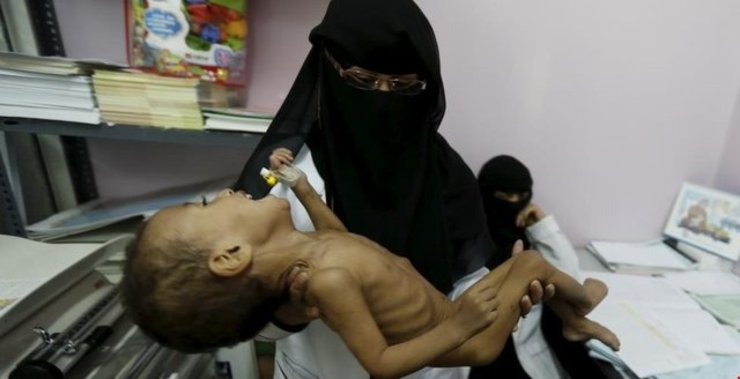 گرسنگی و مرگ در کمین هزاران یمنی