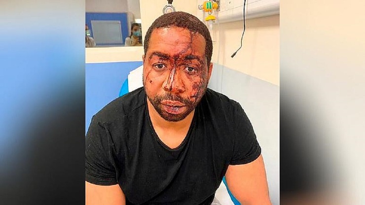 ضرب و جرح مرد سیاهپوست به دست پلیس فرانسه؛ ۴ مامور از کار تعلیق شدند
