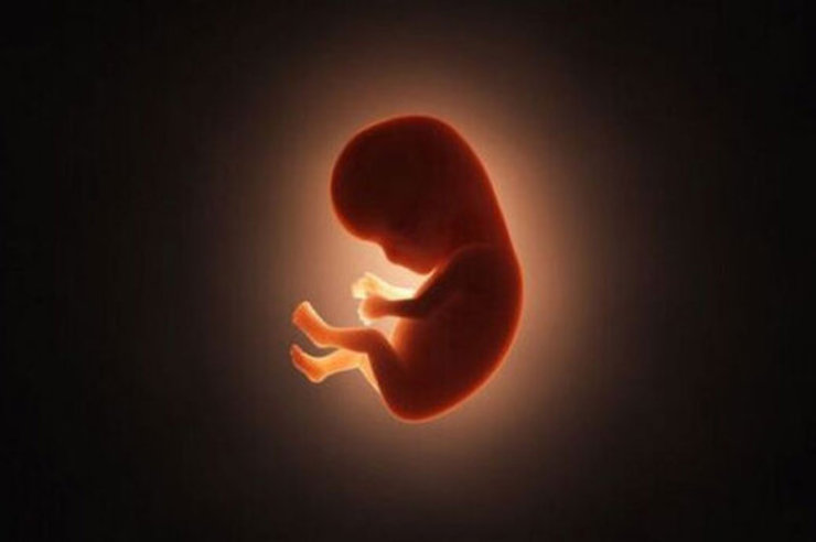 وزارت بهداشت: با طرح جدید مجلس درباره سقط جنین،۷۰ هزار ناهنجاری گریبان مردم را خواهد گرفت