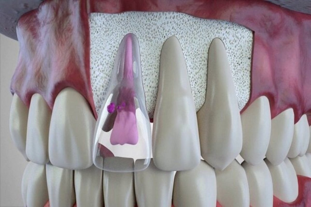 نکات مهم در خصوص سلامت دهان و دندان