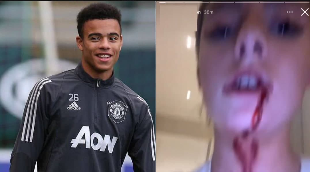 ستاره قرمزها نامزدش را کتک زد/عکس ستاره قرمزها نامزدش را کتک زد/عکس