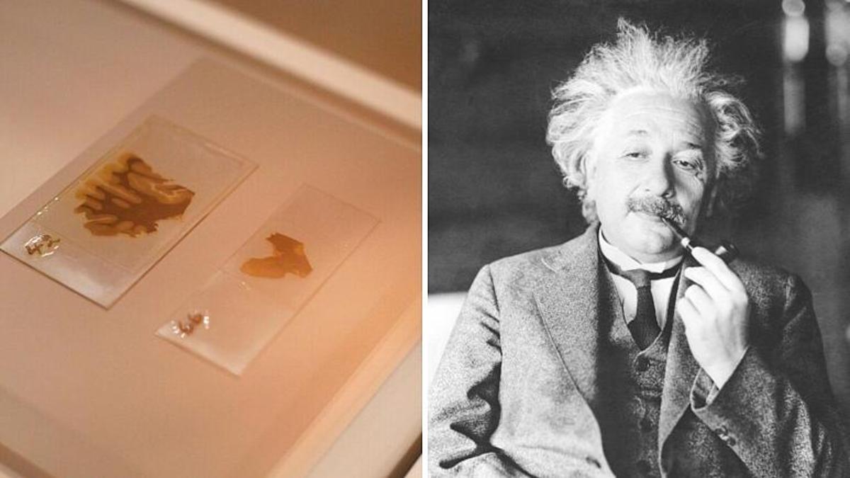 چه کسی مغز آلبرت اینشتین را دزدید؟