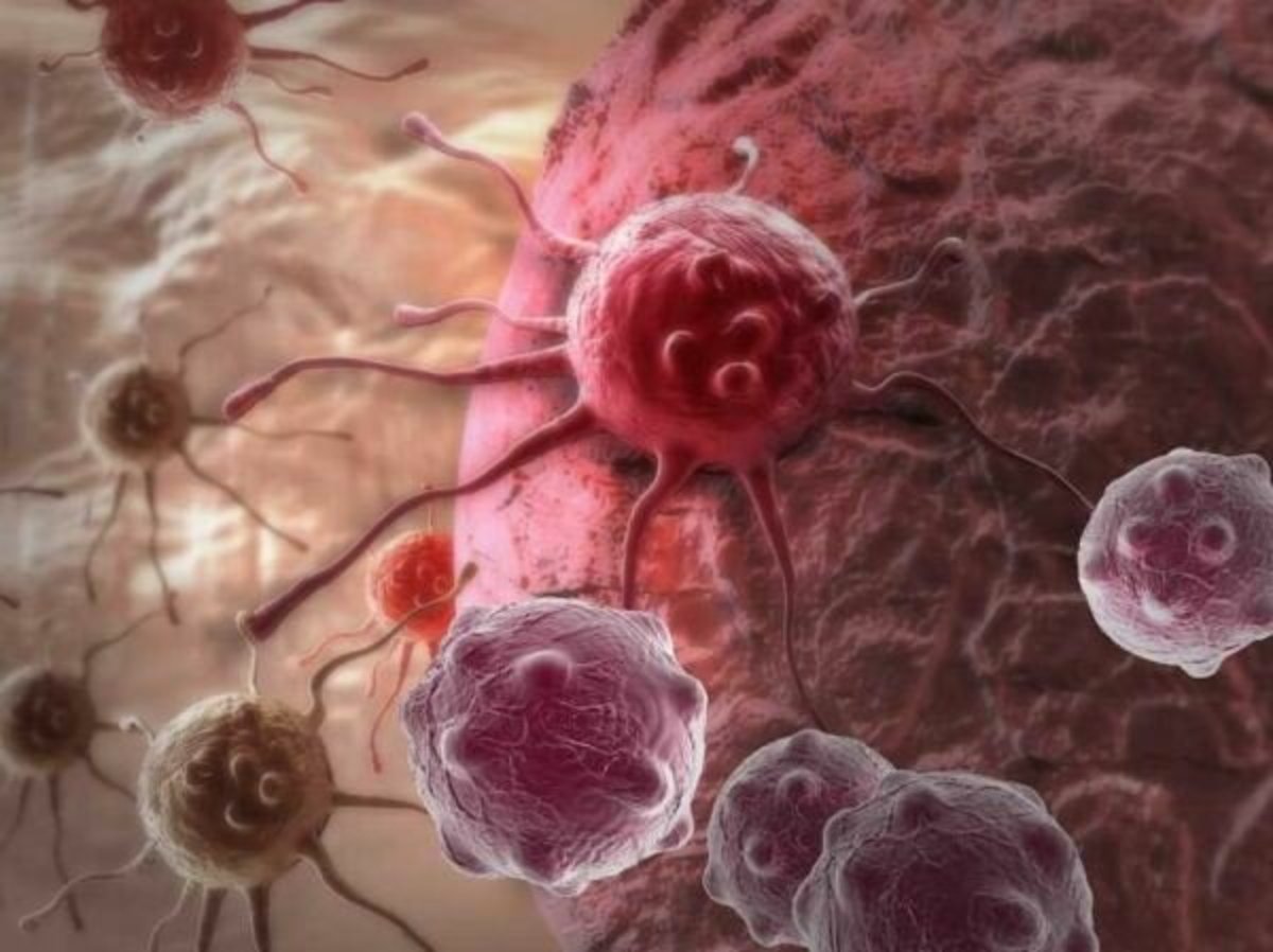 کشف پروتئینی که مانع گسترش سرطان پروستات می‌شود