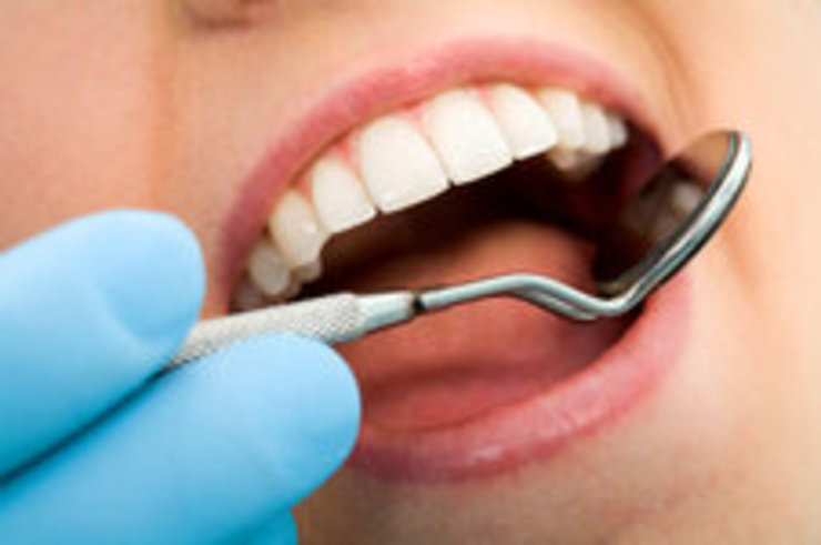 از بی‌عقل‌ترین دندان‌ها چه می‌دانید؟