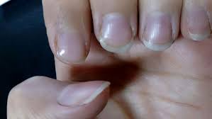 رنگ آبی ناخنها نشان چیست؟