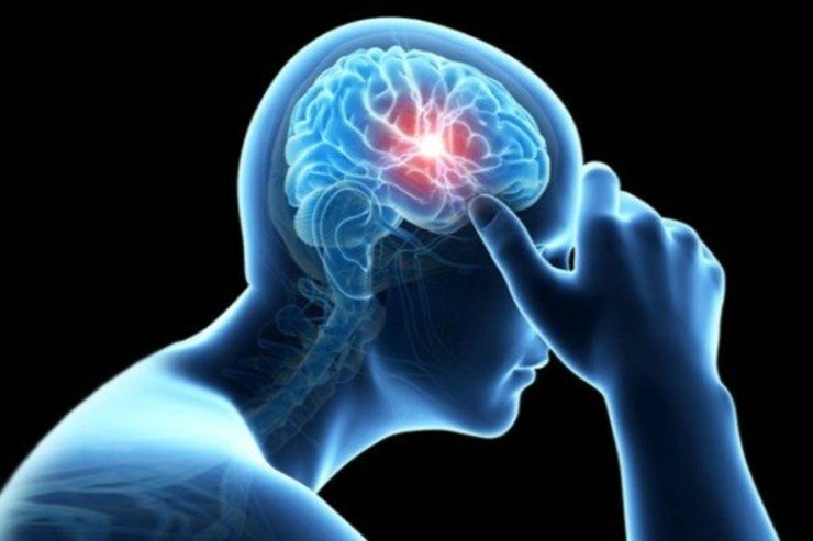 کرونا خطر سکته مغزی را افزایش می‌دهد؟