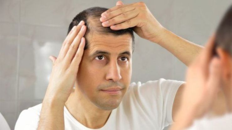 علت ریزش مو و راهکار پرپشت شدن مو چیست