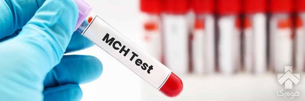 MCH و MCV در آزمایش خون چیست؟ MCH و MCV در آزمایش خون چیست؟