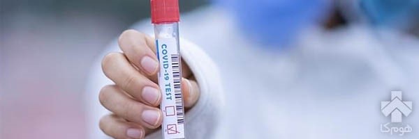 چه زمانی برای انجام تست کرونا در منزل اقدام کنیم؟