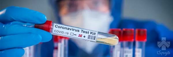 چه زمانی برای انجام تست کرونا در منزل اقدام کنیم؟