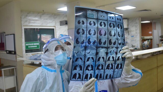 آنچه باید در مورد نوع دلتا پلاس ویروس کرونا بدانید آنچه باید در مورد نوع دلتا پلاس ویروس کرونا بدانید