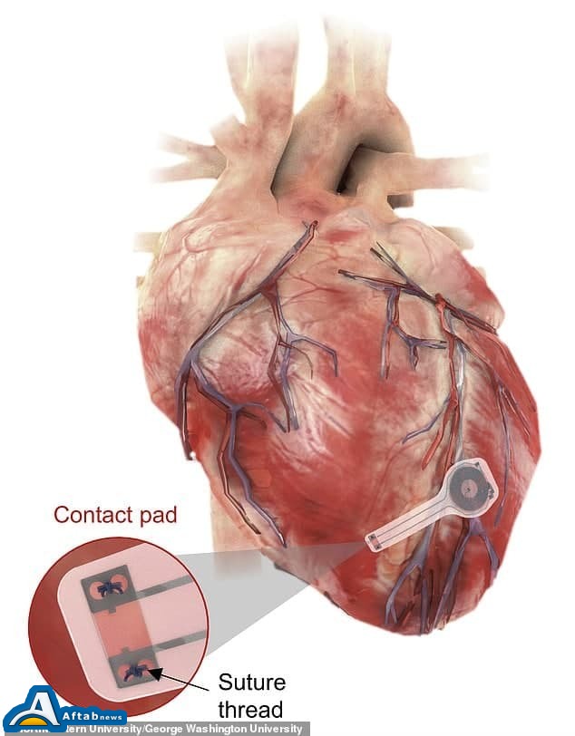 انقلابی تازه در ساخت ضربان‌ساز‌های قلب