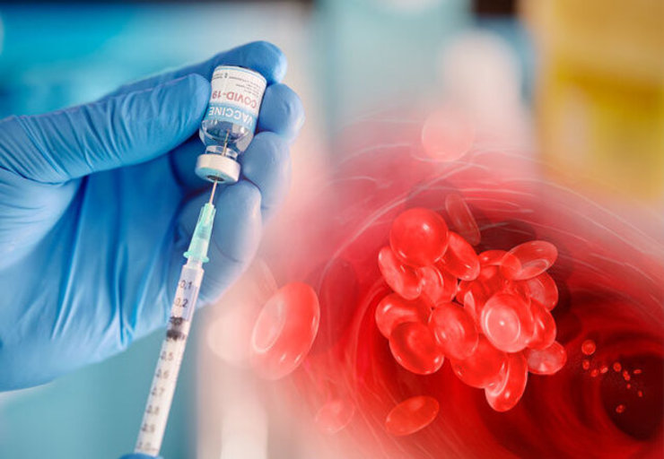 لخته‌شدن خون ناشی از تزریق واکسن کرونا درمان می‌شود