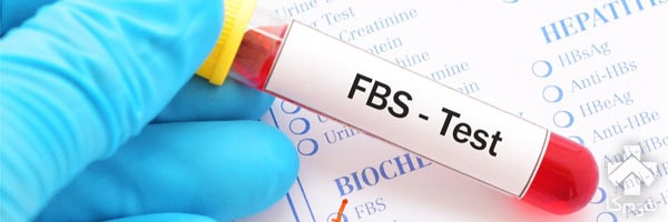 بهترین روش برای انجام تست قند چیست؟