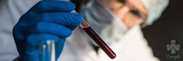 بهترین روش برای انجام تست قند چیست؟