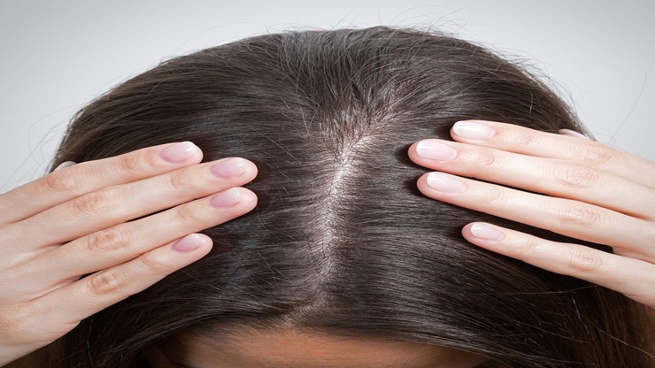 افزایش تراکم مو با چند روش خانگی