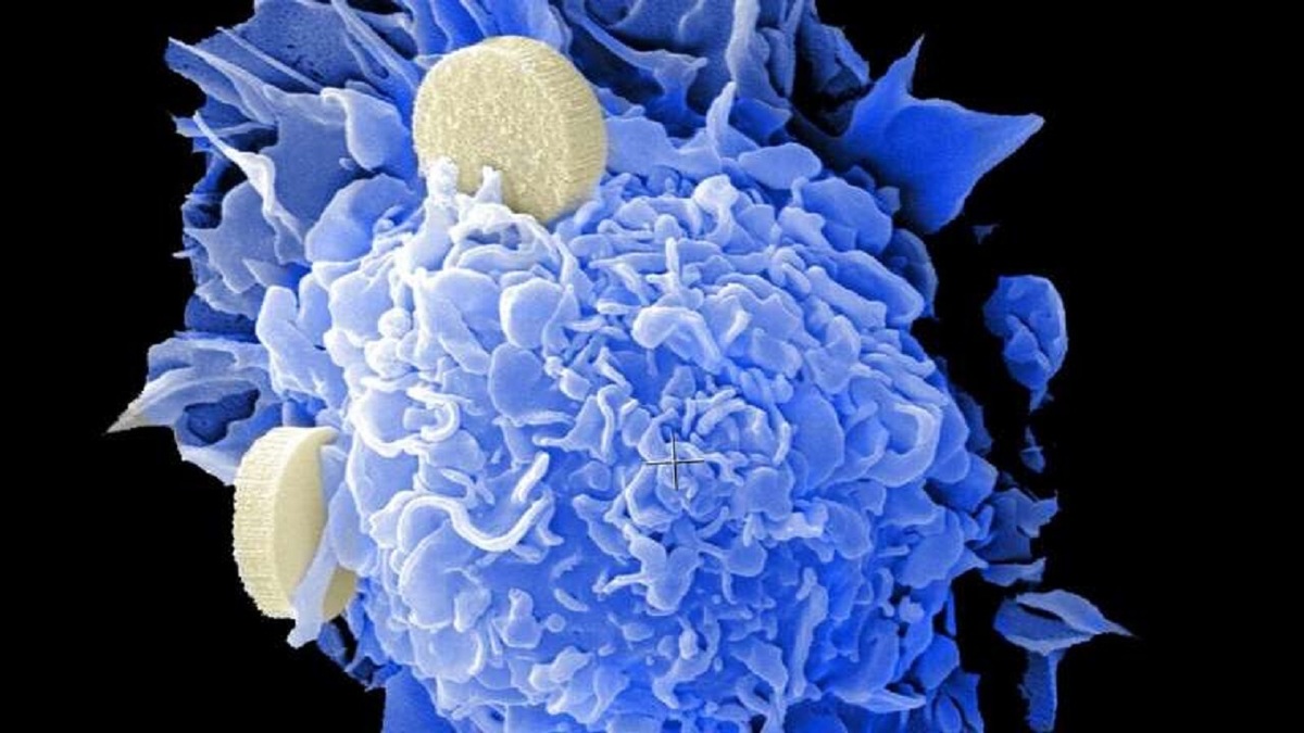 تشخیص سریع سرطان با استفاده از مهندسی نانو ذرات