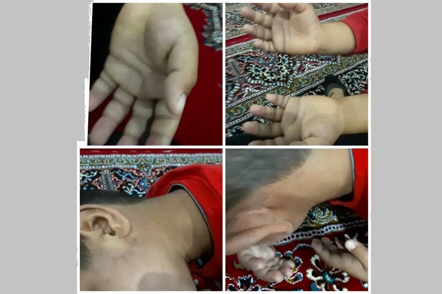 شکنجه دانشآموز کلاس اولی توسط معلمش