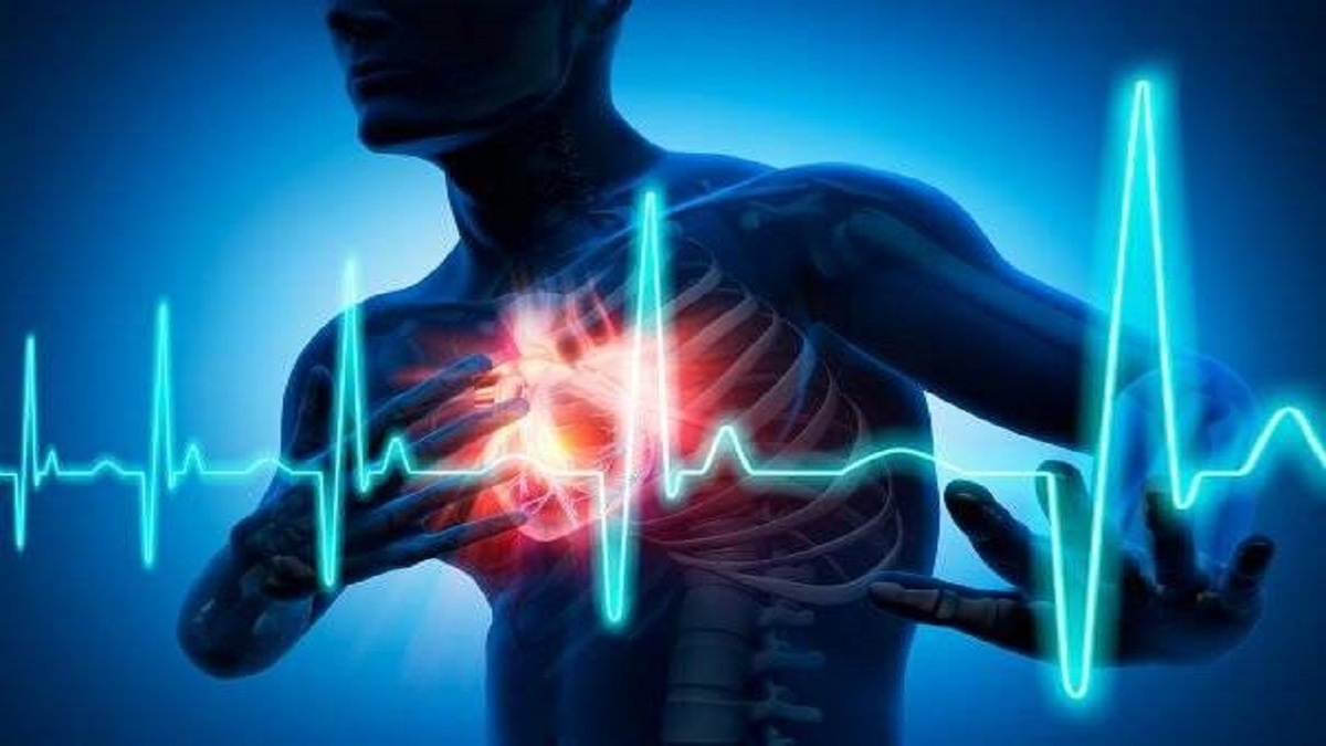 کمک داروی نقرس به توقف حملات قلبی