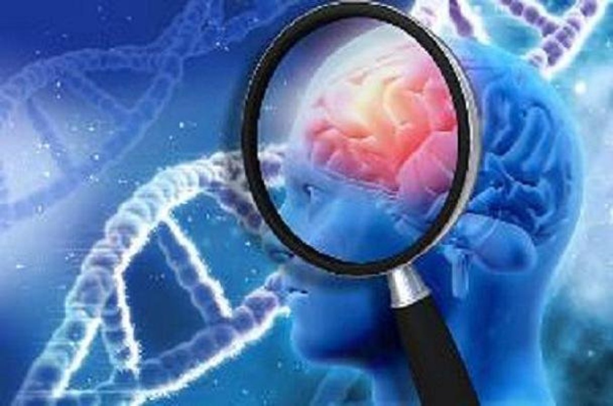 گزارش جدید محققان درباره آلزایمر