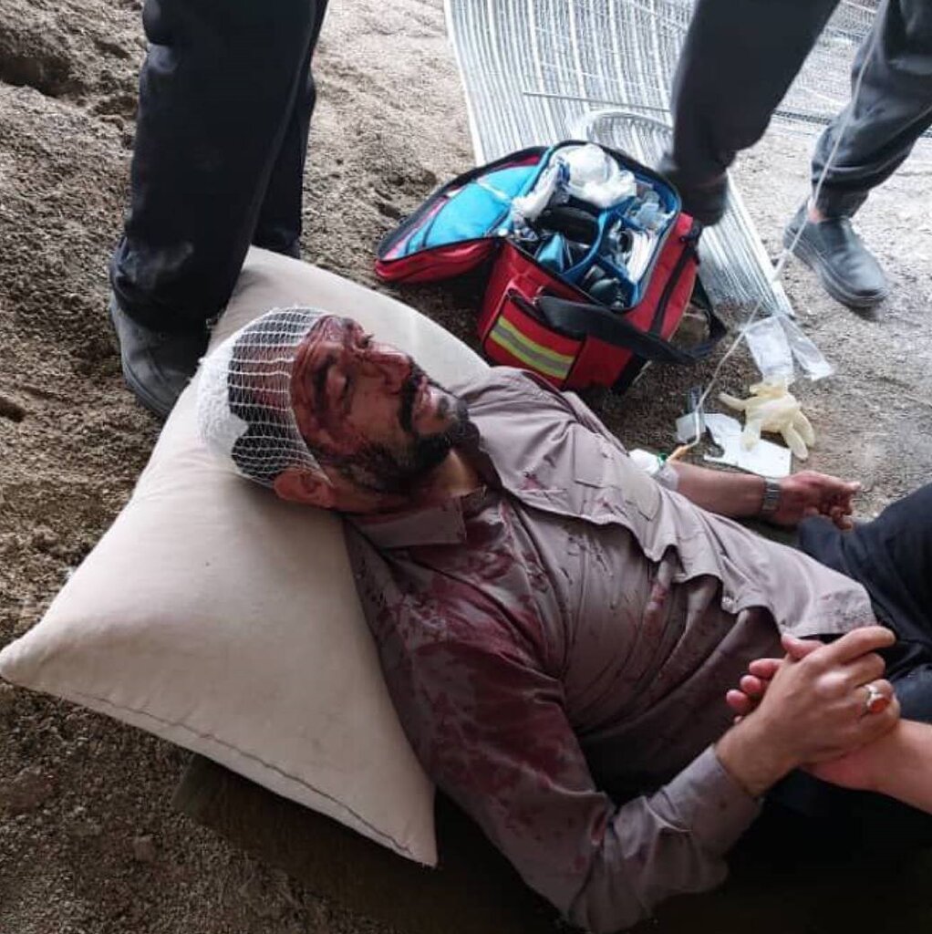 حمله افراد ناشناس با چاقو به شهردار ناحیه ۳ حمله افراد ناشناس با چاقو به شهردار ناحیه ۳