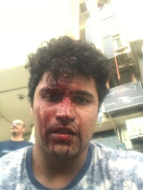 ضرب و شتم شدید ملی&zwnj;پوش وزنه&zwnj;برداری ایران