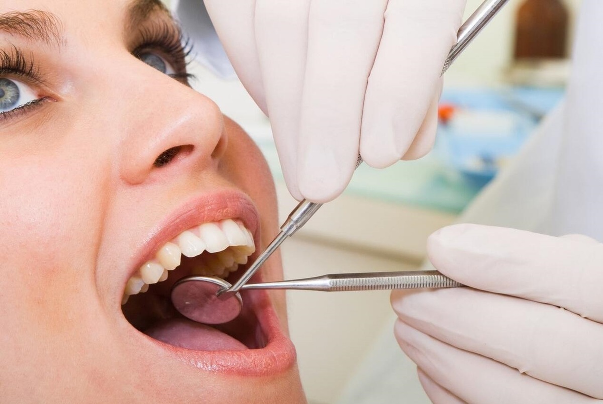 میزان دوام دندان‌ها بعد از عصب کشی چقدر است؟