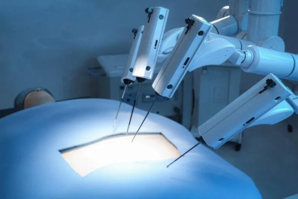 چرا پزشکان جراحی رباتیک را به جراحی سنتی ترجیح می‌دهند؟