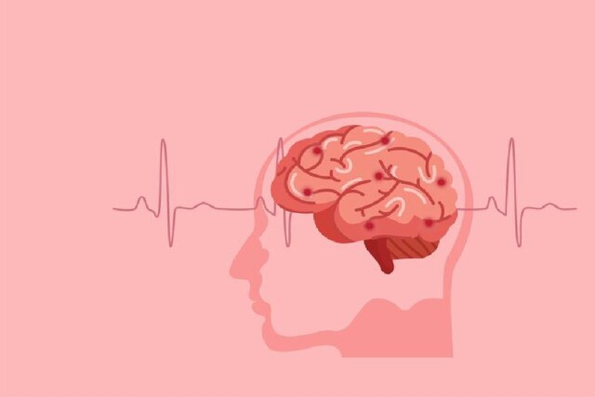 روشی برای ذهن‌خوانی بیماران دچار آسیب‌های مغزی