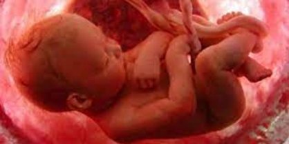 غربالگری سندروم داون و موضع عجیب وزارت بهداشت