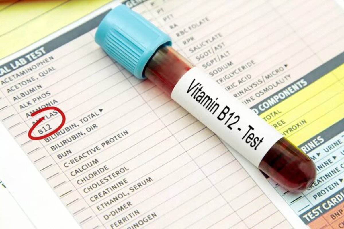نشانه‌های کمبود ویتامین B ۱۲ که در صورت ظاهر می‌شود