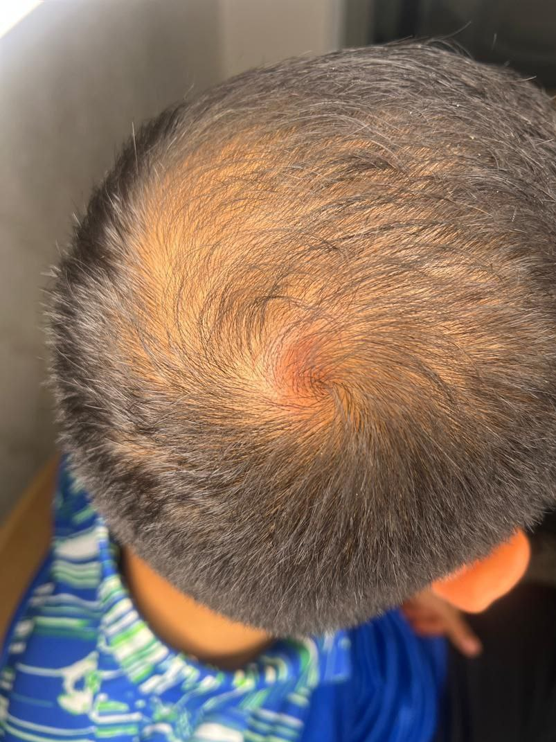 جراحت سر دروازهبان پیکان پس از گل مردود استقلال جراحت سر دروازهبان پیکان پس از گل مردود استقلال