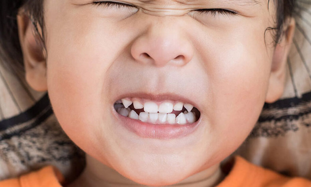 چگونه می‌توان دندان قروچه را کنترل کرد؟
