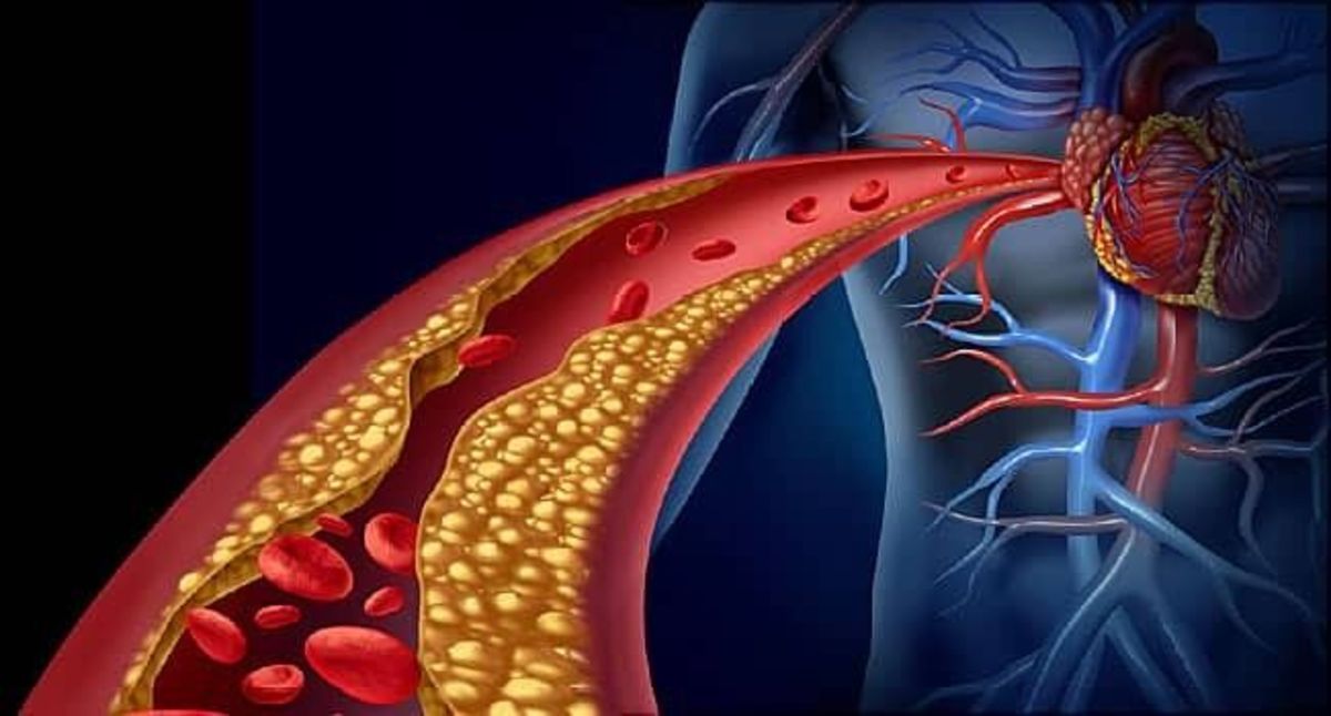 نشانه‌های عجیب از کلسترول بالا که نباید نادیده گرفت