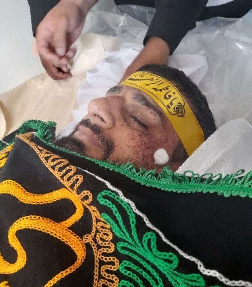 اولین تصویر از امام جماعت زاهدان بعد از ترور اولین تصویر از امام جماعت زاهدان بعد از ترور