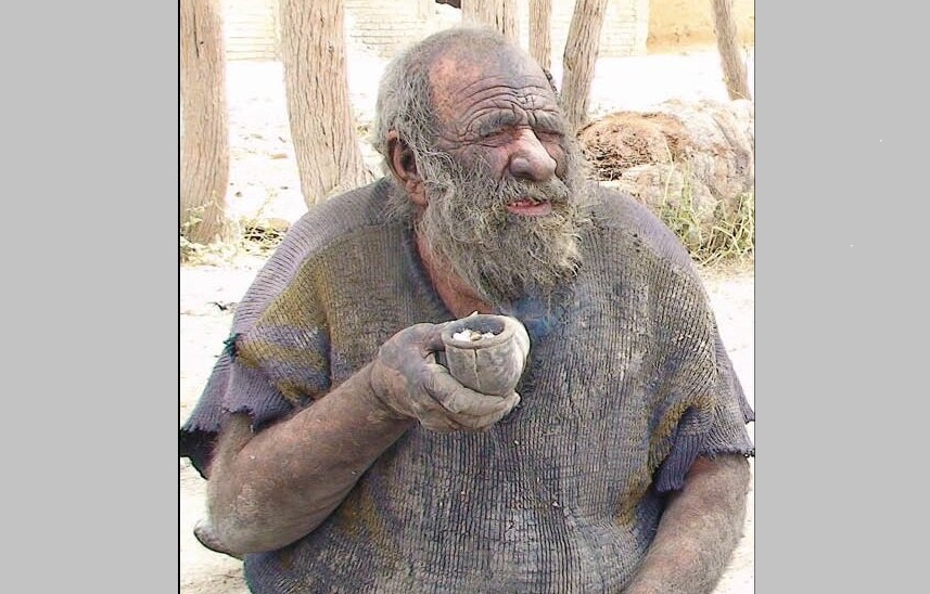 عجایب 60 سال حمام‌نرفتن!