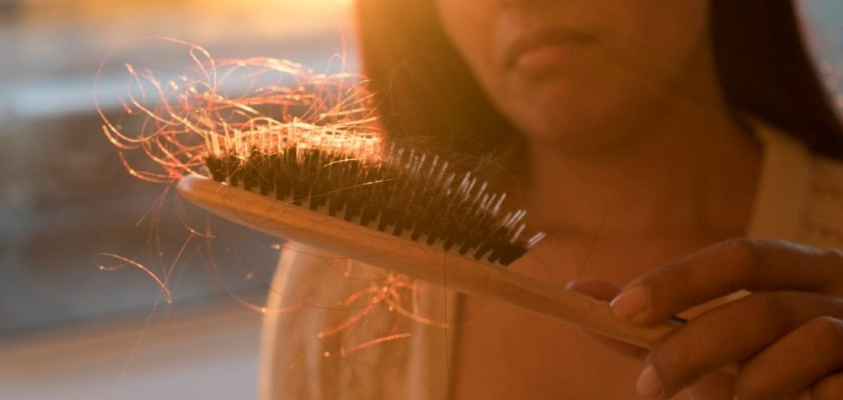 ۵ مورد از بهترین ویتامین‌ها که برای پیشگیری از ریزش مو موثرند