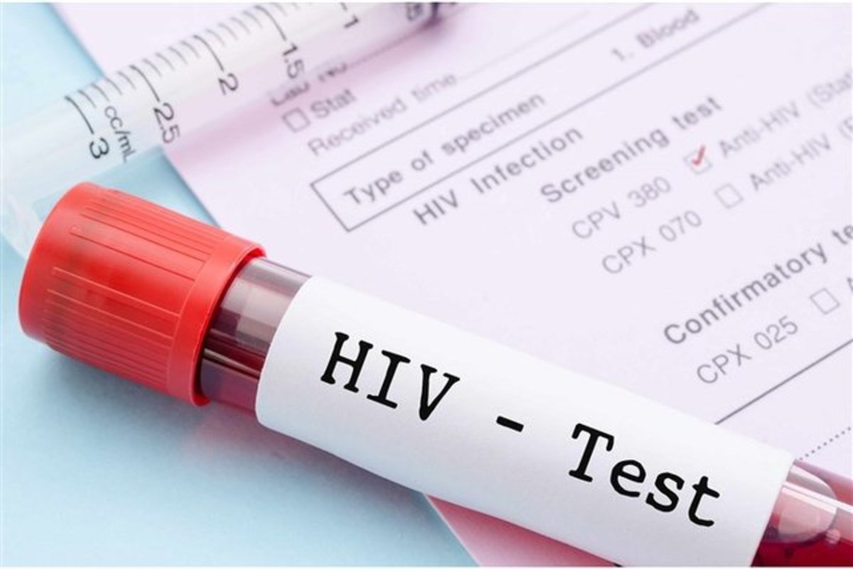 آخرین وضعیت HIV در ایران