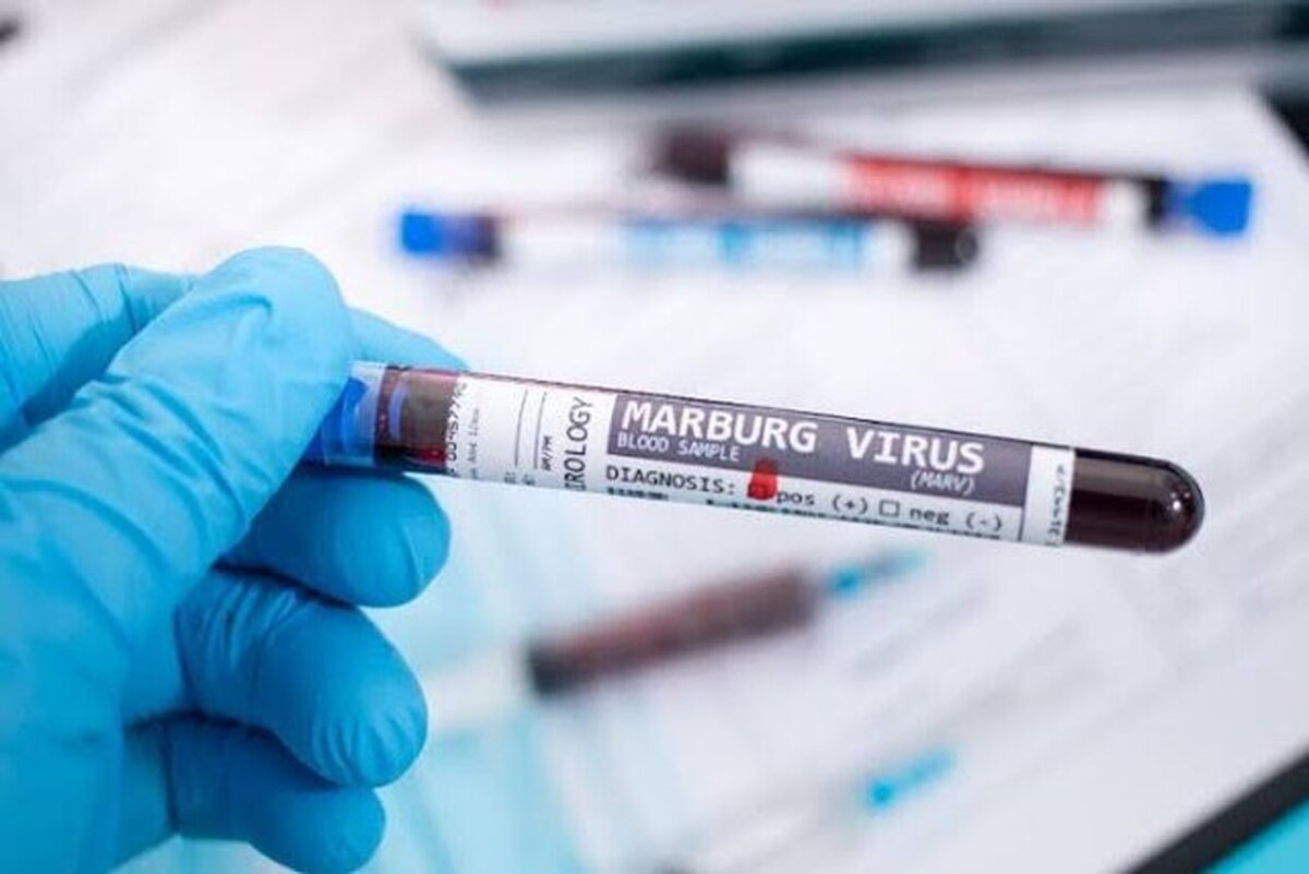 هشدار کشور‌های عربی به مسافران درباره ویروس «ماربورگ»