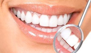 روش‌های سفید کردن دندان چیست؟
