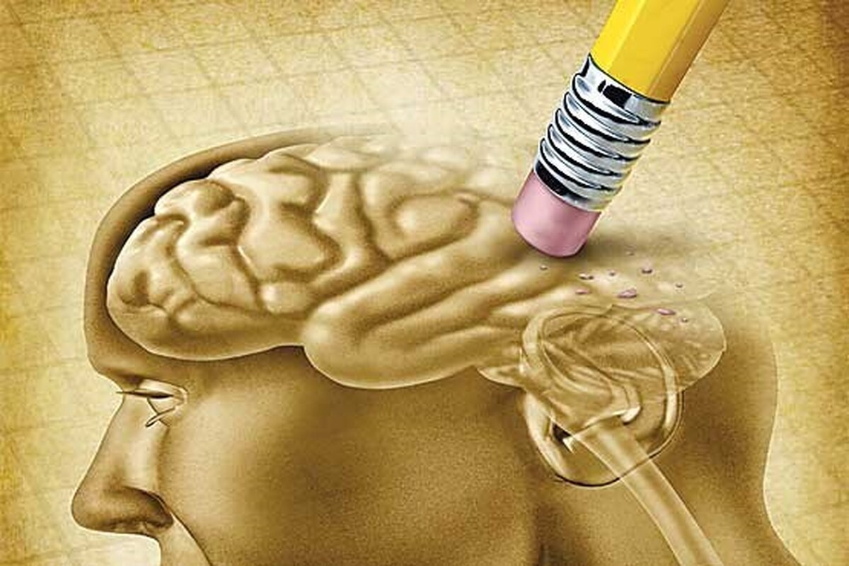 آسیب خفیف سر هم احتمال سکته مغزی را افزایش می‌دهد
