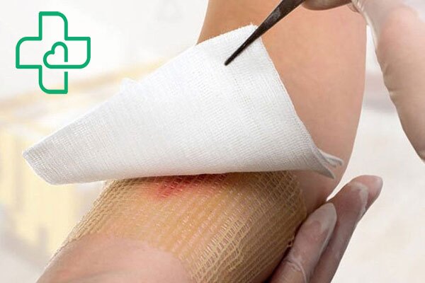 در هنگام ایجاد زخم باز و شدید چه کارهایی باید انجام دهیم؟ در هنگام ایجاد زخم باز و شدید چه کارهایی باید انجام دهیم؟