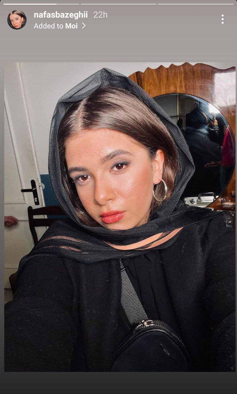 عکس| تغییر چهره شدید نفس بازغی همه را متعجب کرد!