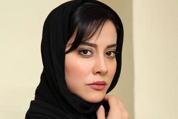 تفاوت عجیب چهره خانم بازیگر قبل از عمل جراحی