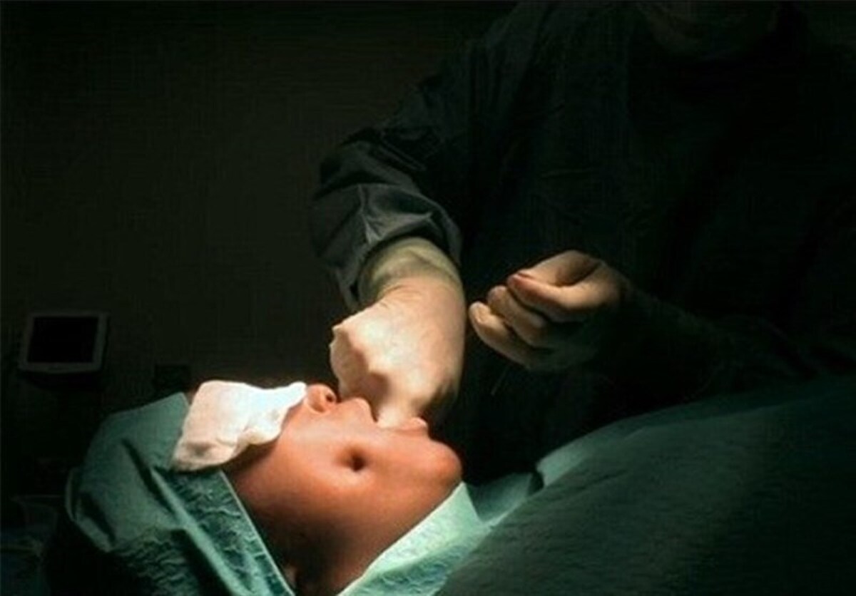 فوت یک زن بر اثر جراحی زیبایی در مشهد