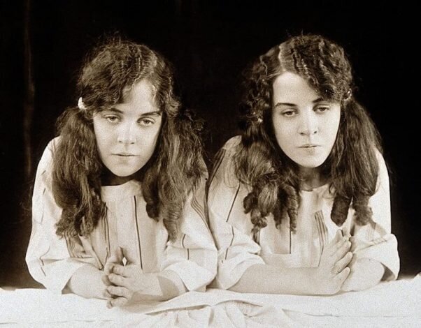 عجیبترین دوقلوهای جهان را بشناسید عجیبترین دوقلوهای جهان را بشناسید