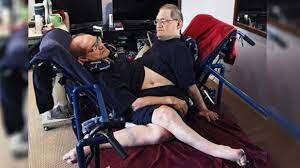 عجیبترین دوقلوهای جهان را بشناسید عجیبترین دوقلوهای جهان را بشناسید