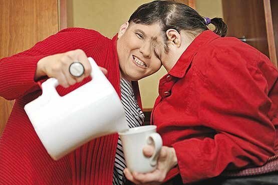 عجیبترین دوقلوهای جهان را بشناسید عجیبترین دوقلوهای جهان را بشناسید